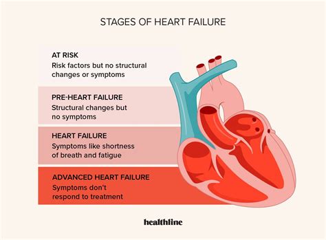 Heart failure .